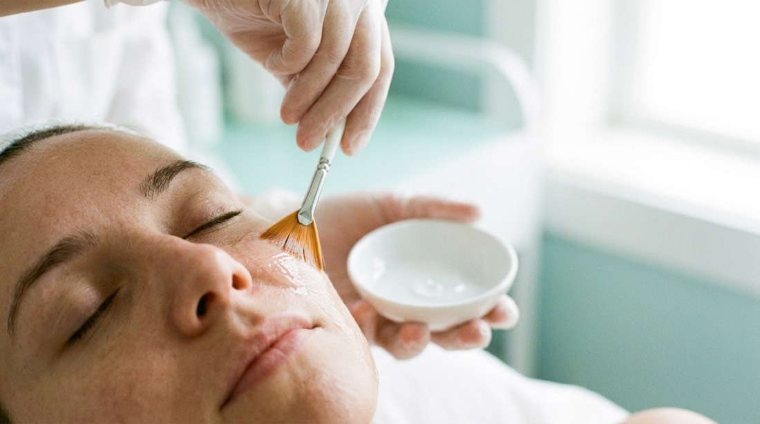 A medical peel being applied